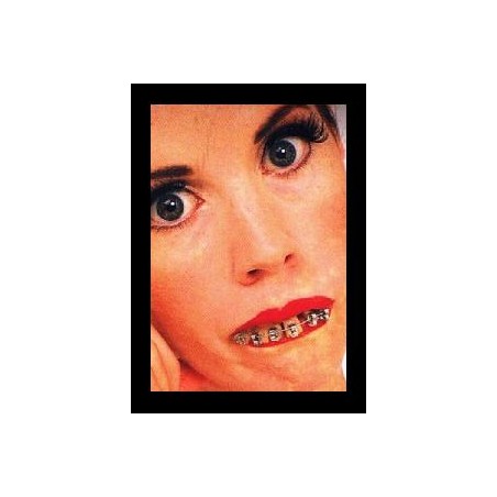 -DIENTES CON HIERROS PROFESIONAL